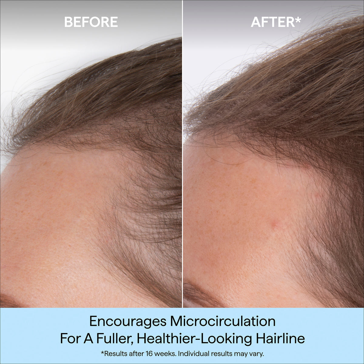 Destined For Density Mega Strength+ Caffeine + Biotin Peptide Density Serum